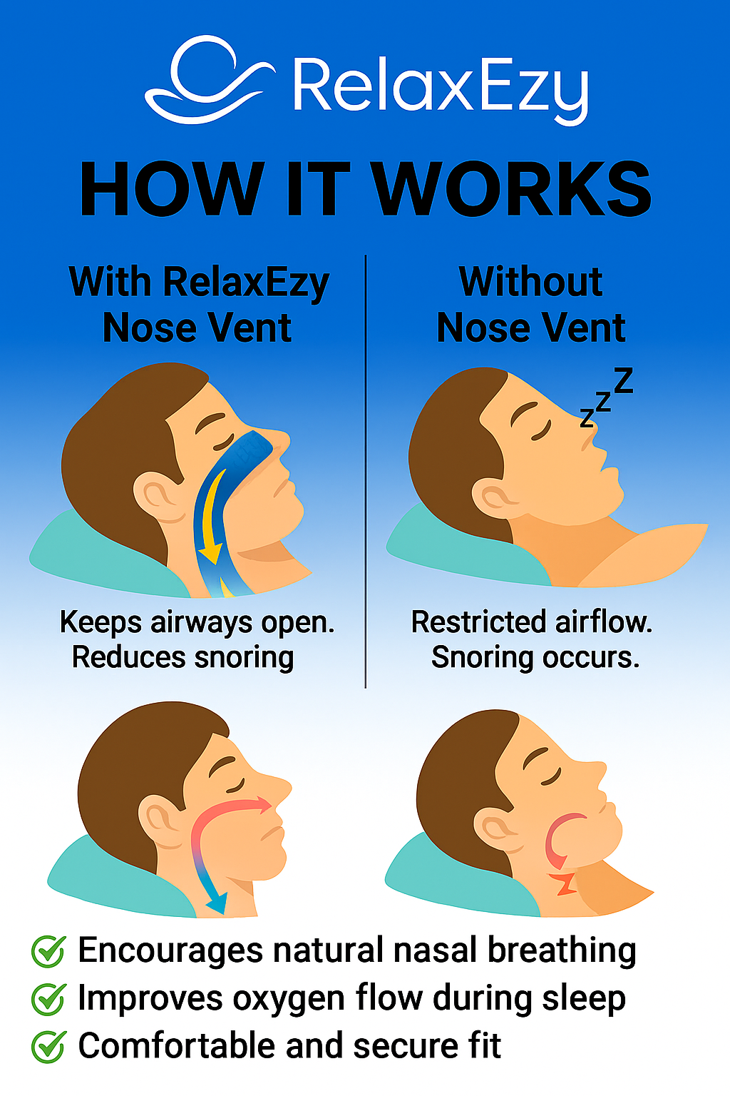 Anti Snoring Nose Vent