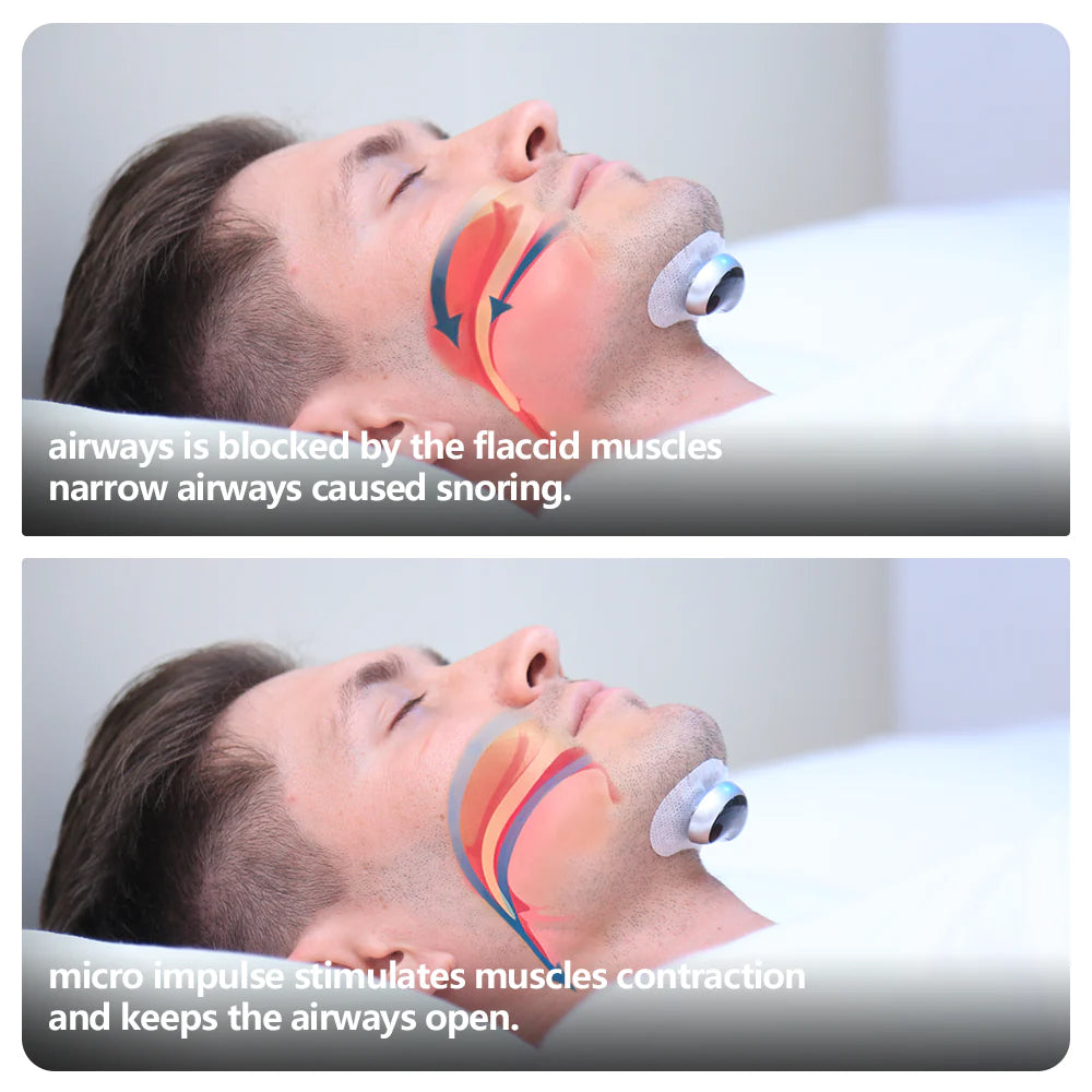 Muscle Stimulator Plus Anti-snoring Device