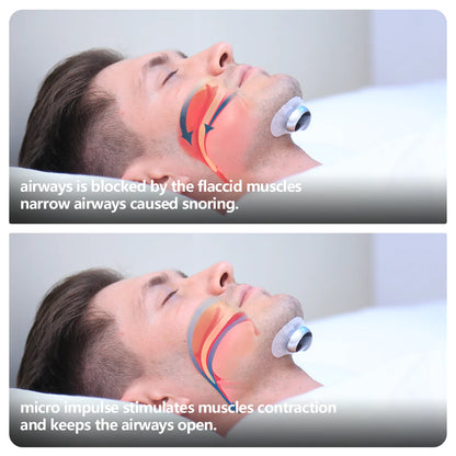 Muscle Stimulator Plus Anti-snoring Device